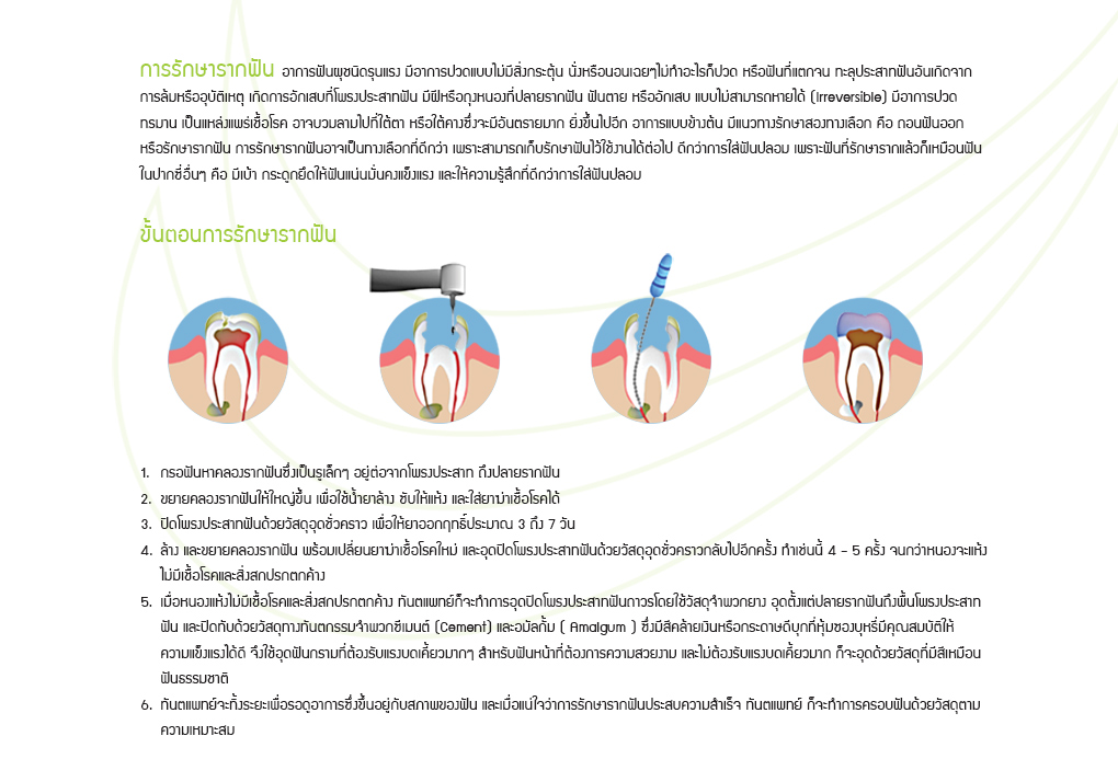 บริการรักษารากฟัน